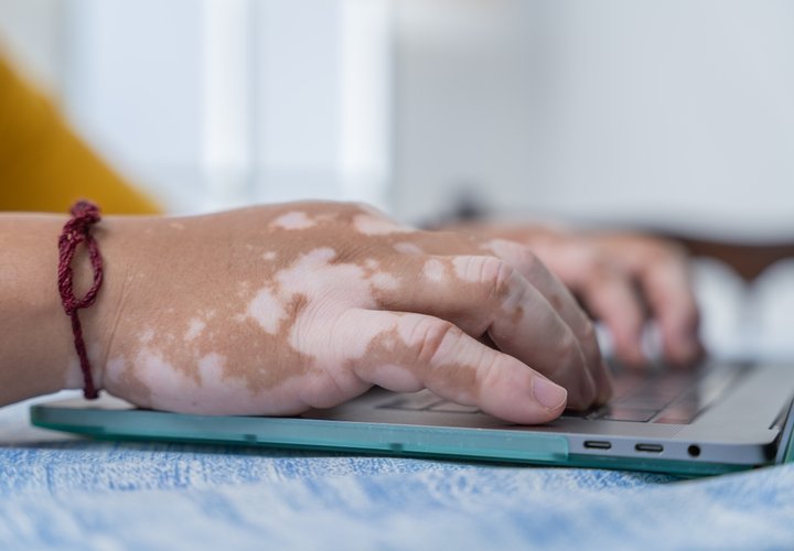 MPN group meeting (CMML, ET, MF and PV)